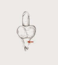 动力肌肉及其张力以增加力量